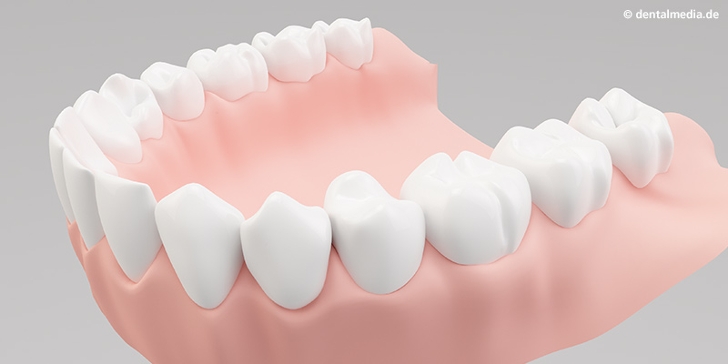 Ästhetisch anspruchsvolles Endergebnis Ästhetisch anspruchsvolles Endergebnis